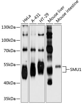 SMU1 Antibody in Western Blot (WB)