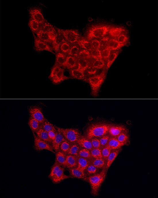 COL4A5 Antibody in Immunocytochemistry (ICC/IF)