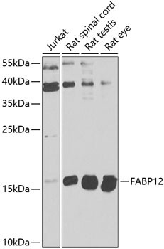 FABP12 Antibody in Western Blot (WB)