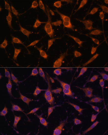 Fibulin 5 Antibody in Immunocytochemistry (ICC/IF)