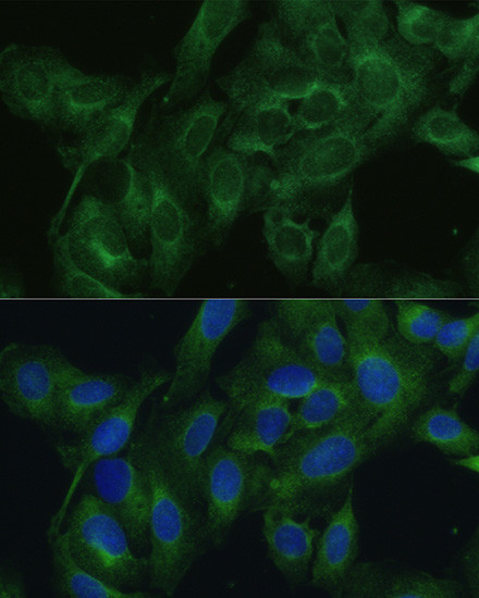 FRMD6 Antibody in Immunocytochemistry (ICC/IF)