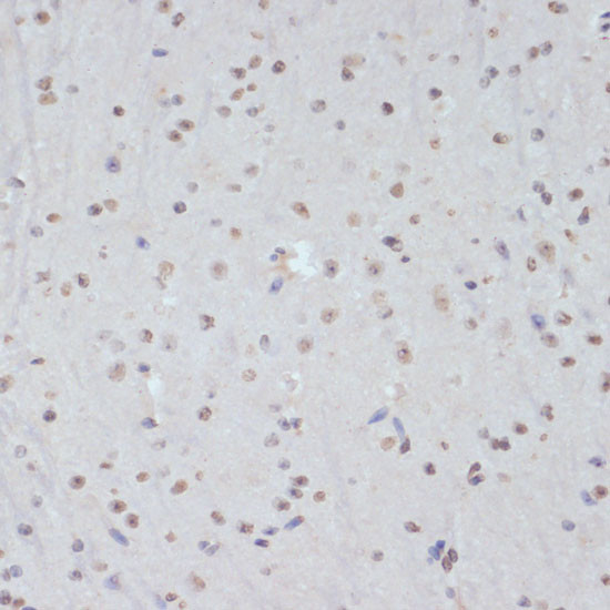 Phospho-CDK1 (Tyr15) Antibody in Immunohistochemistry (Paraffin) (IHC (P))