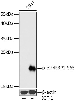 Phospho-4EBP1 (Ser65) Antibody in Western Blot (WB)