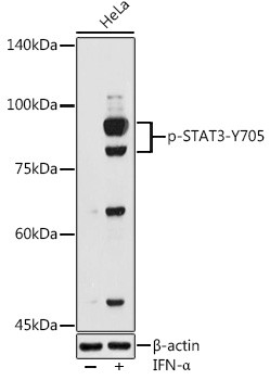 Phospho-STAT3 (Tyr705) Antibody in Western Blot (WB)