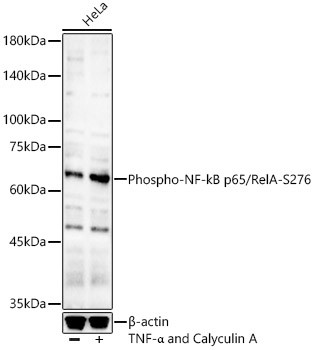 Phospho-NFkB p65 (Ser276) Antibody in Western Blot (WB)