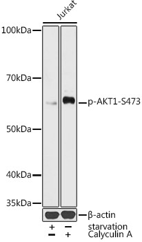 Phospho-AKT1 (Ser473) Antibody in Western Blot (WB)