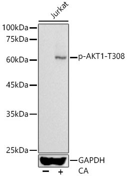 Phospho-AKT1 (Thr308) Antibody in Western Blot (WB)