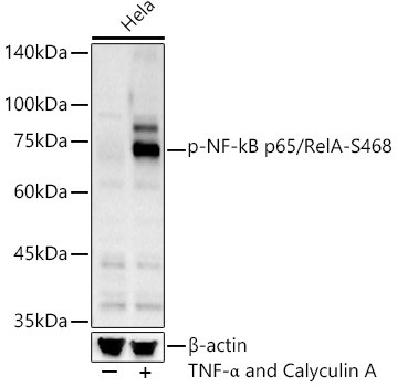 Phospho-NFkB p65 (Ser468) Antibody in Western Blot (WB)