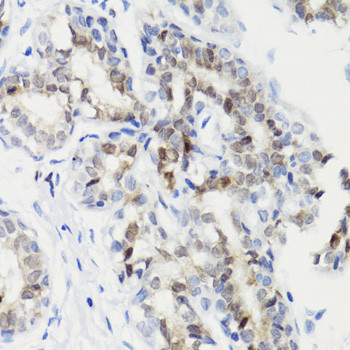 Phospho-STAT3 (Ser727) Antibody in Immunohistochemistry (Paraffin) (IHC (P))
