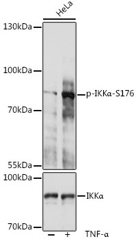Phospho-IKK alpha (Ser176) Antibody in Western Blot (WB)