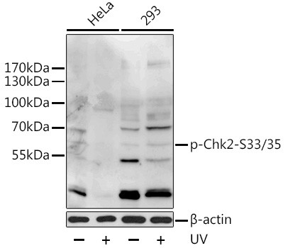 Phospho-CHK2 (Ser33, Ser35) Antibody in Western Blot (WB)