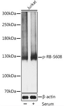 Phospho-Rb (Ser608) Antibody in Western Blot (WB)