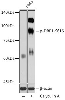 Phospho-DNM1L (Ser616) Antibody in Western Blot (WB)