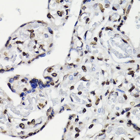 Phospho-STAT5A/B (Tyr694) Antibody in Immunohistochemistry (Paraffin) (IHC (P))