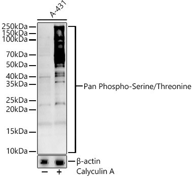 Phosphoserine/threonine Antibody in Western Blot (WB)