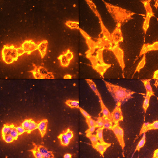 Phosphotyrosine Antibody in Immunocytochemistry (ICC/IF)