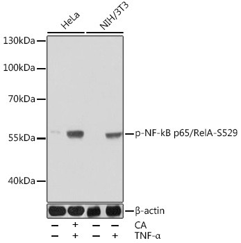 Phospho-NFkB p65 (Ser529) Antibody in Western Blot (WB)