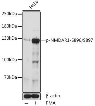 Phospho-NMDAR1 (Ser896, Ser897) Antibody in Western Blot (WB)