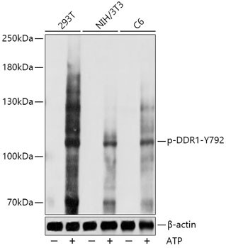 Phospho-MCK10 (Tyr792) Antibody in Western Blot (WB)