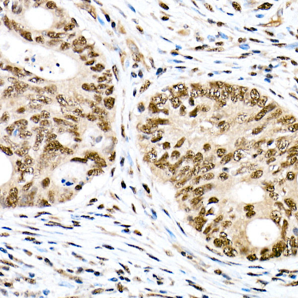 Phospho-FOXO1 (Ser319) Antibody in Immunohistochemistry (Paraffin) (IHC (P))