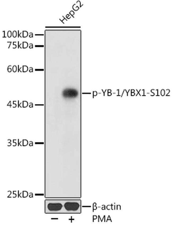 Phospho-YBX1 (Ser102) Antibody in Western Blot (WB)