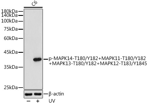 Phospho-p38 MAPK Pan (Thr180, Tyr182, Thr183, Tyr185) Antibody in Western Blot (WB)