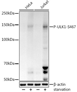 Phospho-ULK1 (Ser467) Antibody in Western Blot (WB)