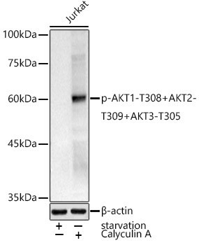 Phospho-AKT1 (Thr308) Antibody in Western Blot (WB)