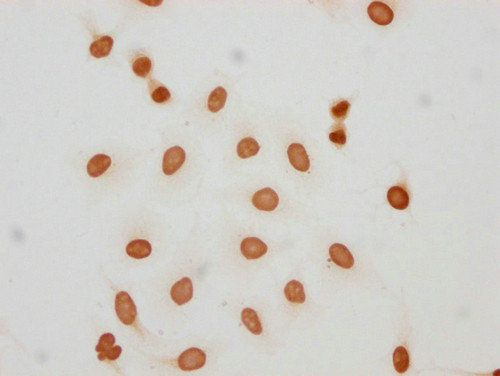 2-hydroxyisobutyryl-HIST1H2AG (Lys5) Antibody in Immunocytochemistry (ICC/IF)