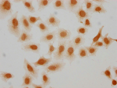2-hydroxyisobutyryl-HIST1H2AG (Lys95) Antibody in Immunocytochemistry (ICC/IF)