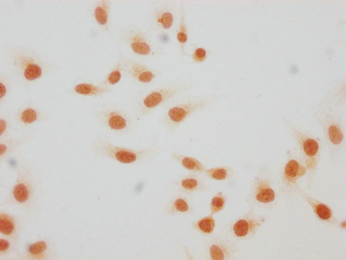 H4K59hib Antibody in Immunocytochemistry (ICC/IF)