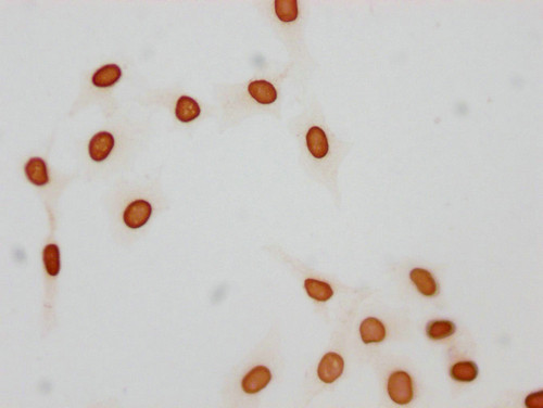 Acetyl-Histone H1.1 (Lys21) Antibody in Immunocytochemistry (ICC/IF)