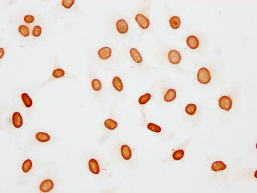 Acetyl-Histone H1.5 (Lys48) Antibody in Immunocytochemistry (ICC/IF)