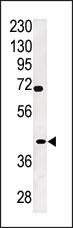 TPST2 Antibody in Western Blot (WB)
