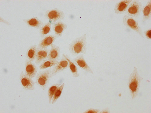 Acetyl-HIST1H2AG (Lys15) Antibody in Immunocytochemistry (ICC/IF)