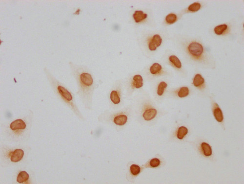 Acetyl-HIST1H2AG (Lys9) Antibody in Immunocytochemistry (ICC/IF)