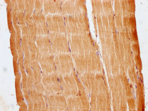 C22orf39 Antibody in Immunohistochemistry (Paraffin) (IHC (P))