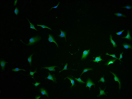 CCHCR1 Antibody in Immunocytochemistry (ICC/IF)