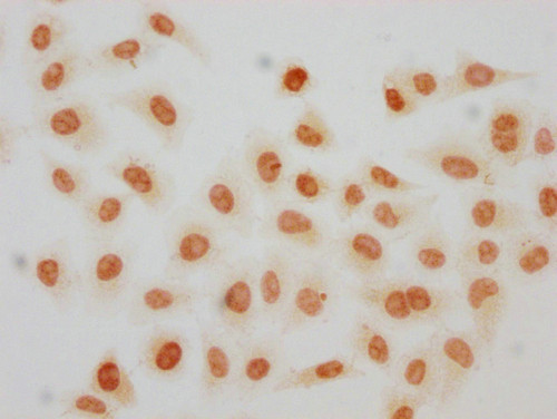 Crotonyl-HIST1H2AG (Lys119) Antibody in Immunocytochemistry (ICC/IF)