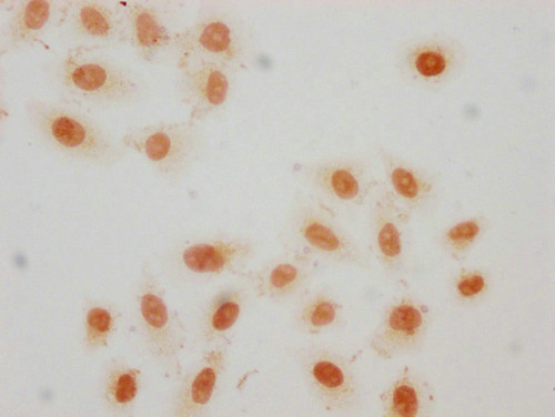Crotonyl-HIST1H2AG (Lys36) Antibody in Immunocytochemistry (ICC/IF)