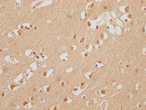 HuC Antibody in Immunohistochemistry (Paraffin) (IHC (P))