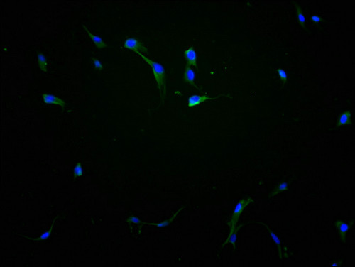 EphA10 Antibody in Immunocytochemistry (ICC/IF)