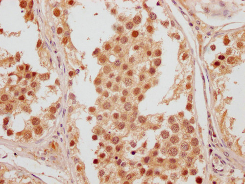 FAM53A Antibody in Immunohistochemistry (Paraffin) (IHC (P))