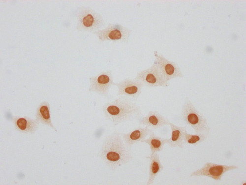 Formyl-Histone H1.3 (Lys140) Antibody in Immunocytochemistry (ICC/IF)
