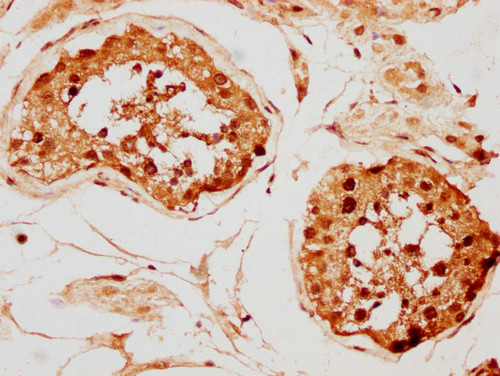 Histone H2A.X Antibody in Immunohistochemistry (Paraffin) (IHC (P))