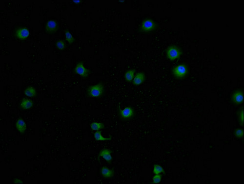 LCMT1 Antibody in Immunocytochemistry (ICC/IF)