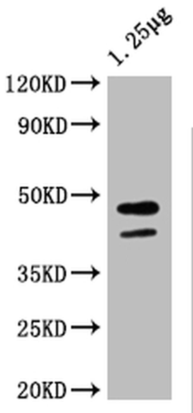 Maltose Binding Protein Antibody in Western Blot (WB)