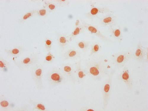 Mono-Methyl-Histone H1.1 (Lys21) Antibody in Immunocytochemistry (ICC/IF)