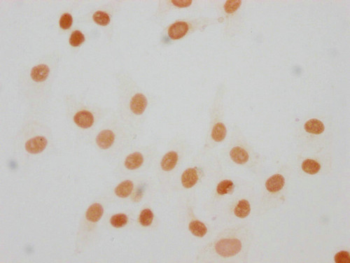 Mono-Methyl-Histone H1.4 (Lys63) Antibody in Immunocytochemistry (ICC/IF)