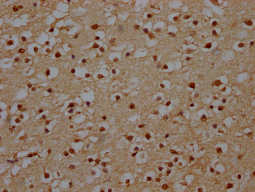 NHLRC1 Antibody in Immunohistochemistry (Paraffin) (IHC (P))